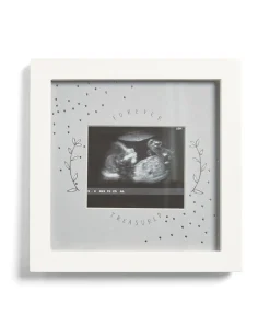 Baby Scan Photo Frame White - Forever Treasured