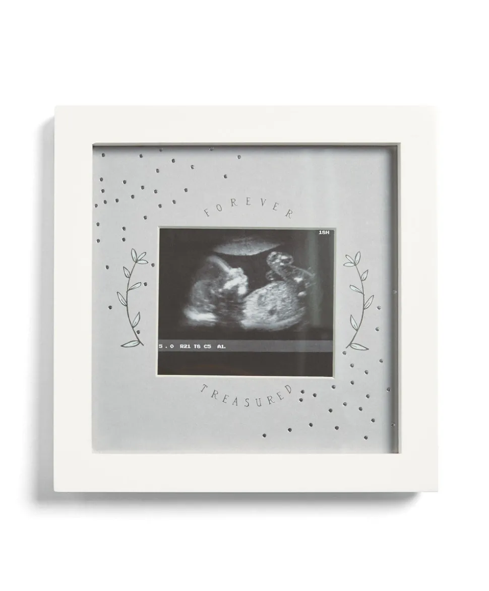 Baby Scan Photo Frame White - Forever Treasured